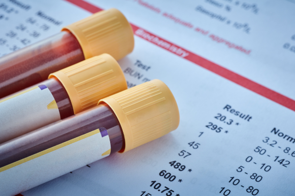 Blood testing is typically used in accident investigations, DUI cases, or impairment testing since it measures active THC in the bloodstream, not just past use. It provides a snapshot of current intoxication levels, making it one of the most reliable (and difficult to beat) test types.